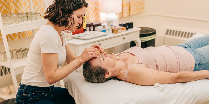 Acupuncture